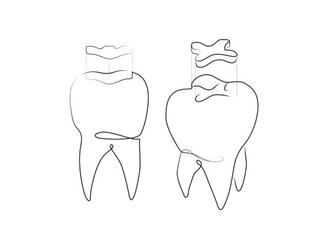 Stages of execution: Illustration