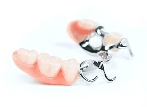  Bugel prosthesis Illustration