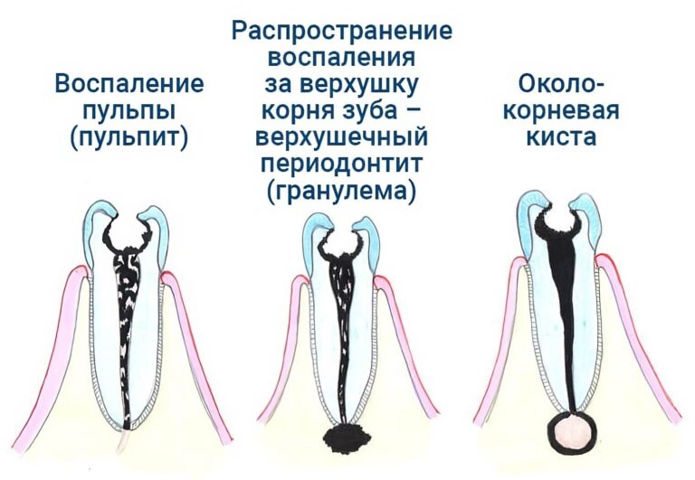 Зубной канал