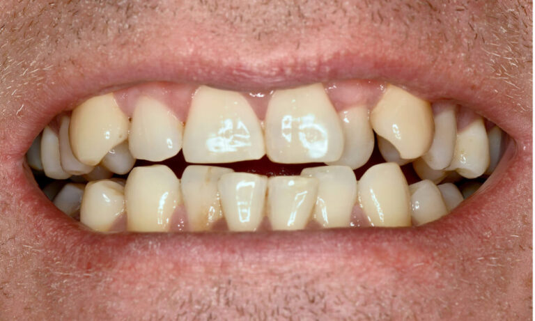 compare-images-0948-1