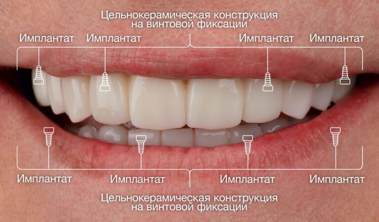compare-images-1998-2-ru