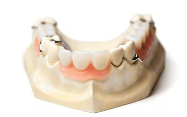 Лечение адентии