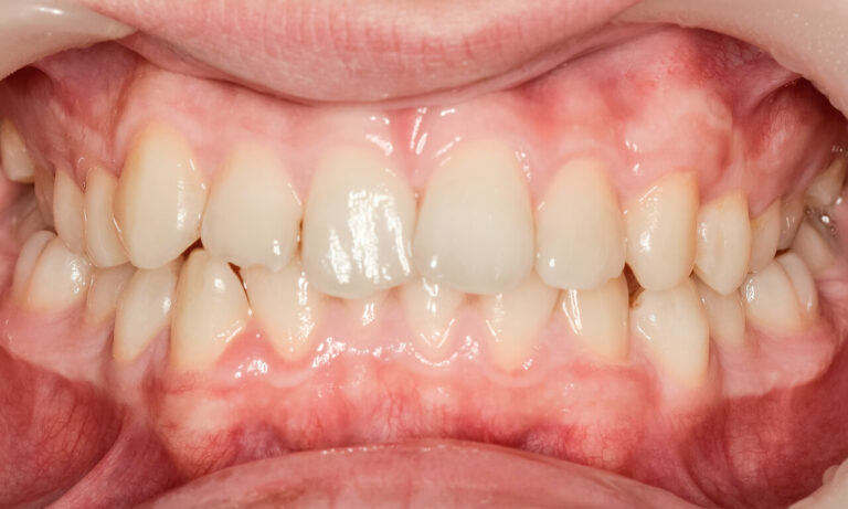 image-before-kj72-1
