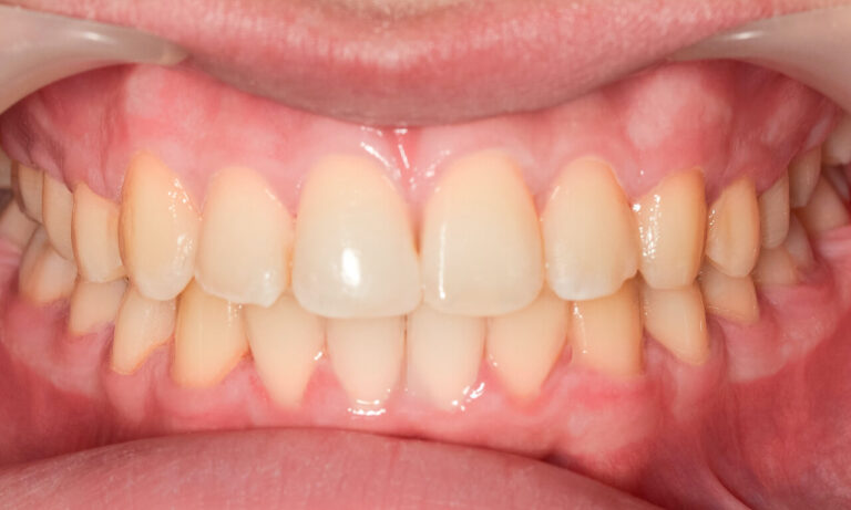 image-before-kj72-2