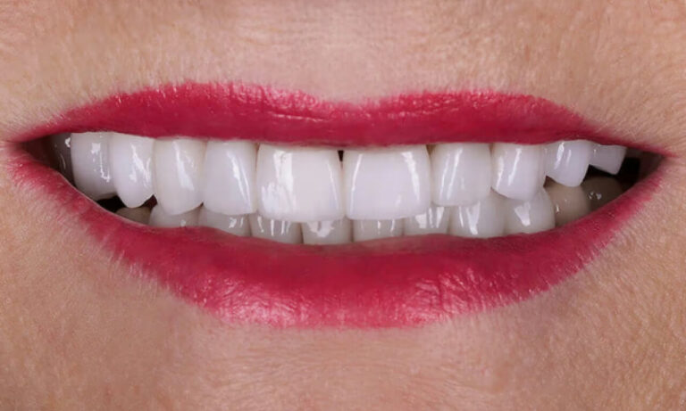 Zirconium. Photo after