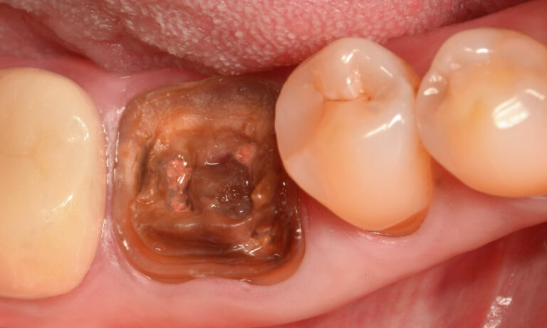 image-compare-0213-1