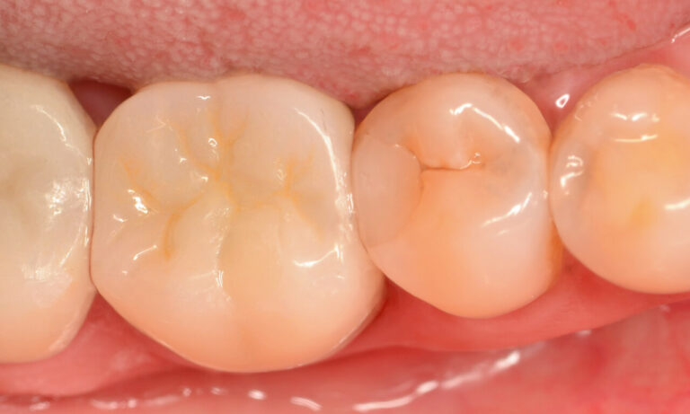 image-compare-0213-2