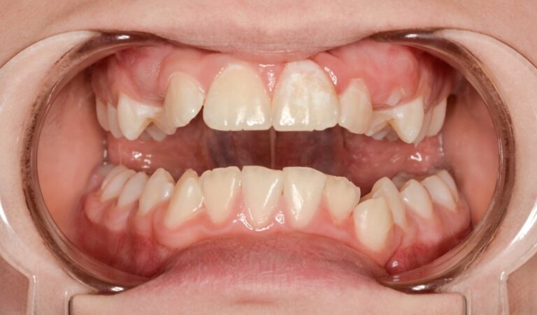 image-compare-jk3-1