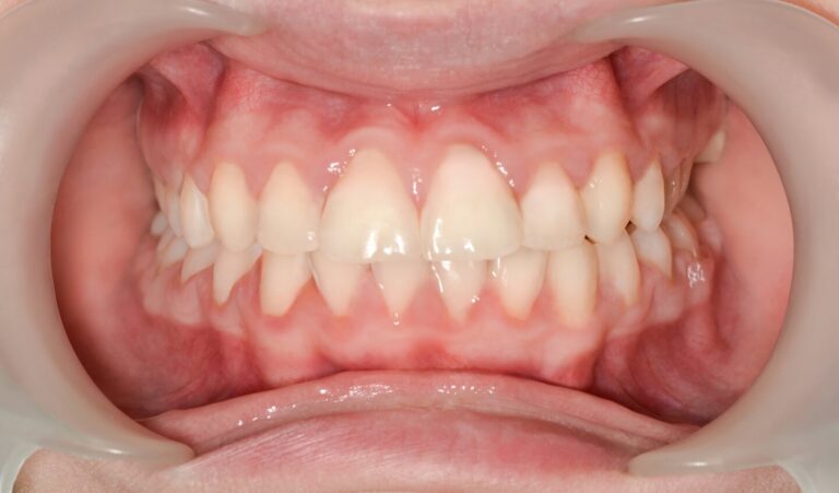 image-compare-jk3-2