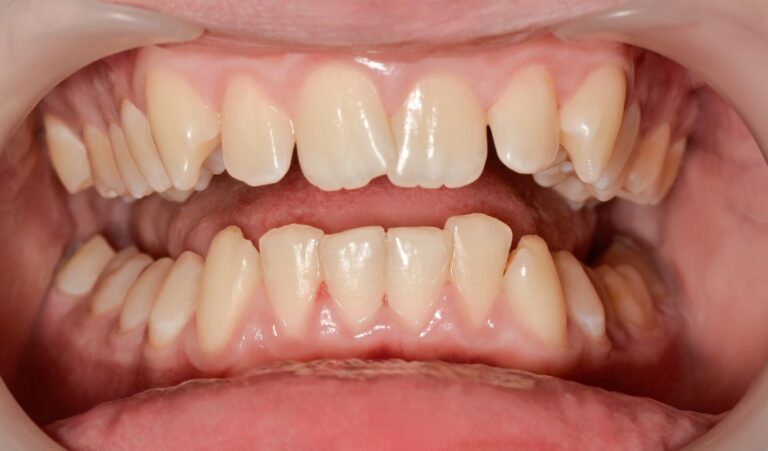 image-compare-jk4-1