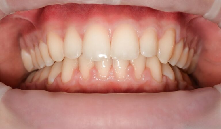 image-compare-jk4-2