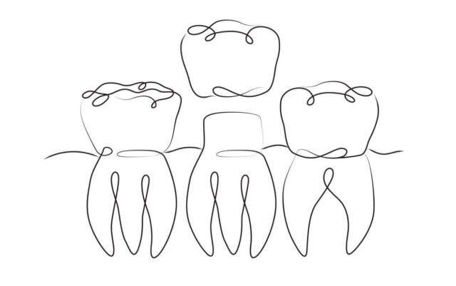 Innovative approaches allow restoring a... Illustration