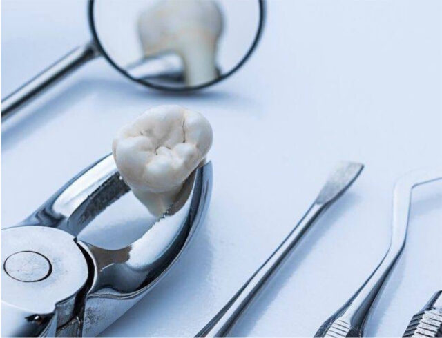 Infrequent complications:

fracture of the lower... Illustration