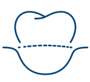 Endodontic treatment