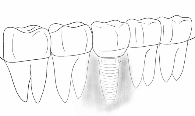 Возможные осложнения и как их избежать Иллюстрация
