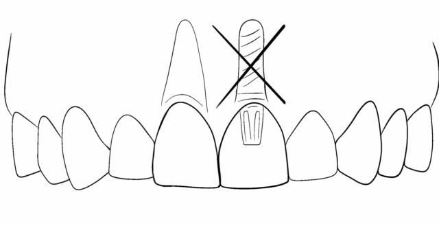 Противопоказания Иллюстрация