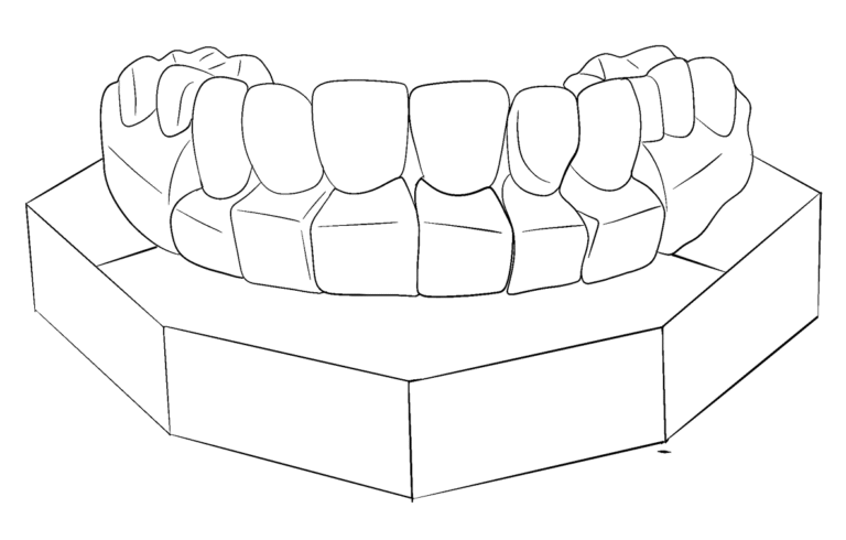 veneer-image-pl23