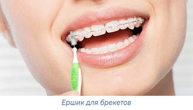 Ершик для брекетов