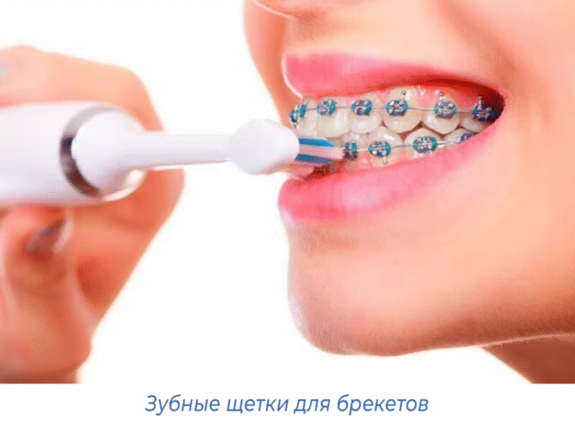 Зубные щетки для брекетов
