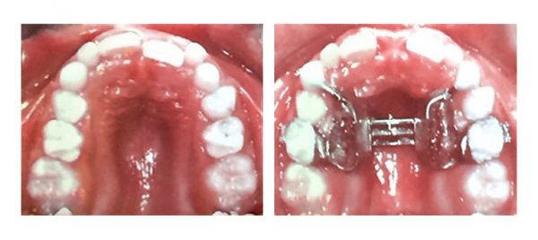 Доктор Галина Матиюк на курсах Dr.Marco Ross Фото 197