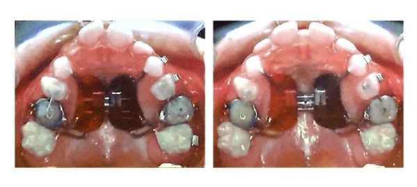 Доктор Галина Матіюк на курсах Dr.Marco Ross. Фото 304