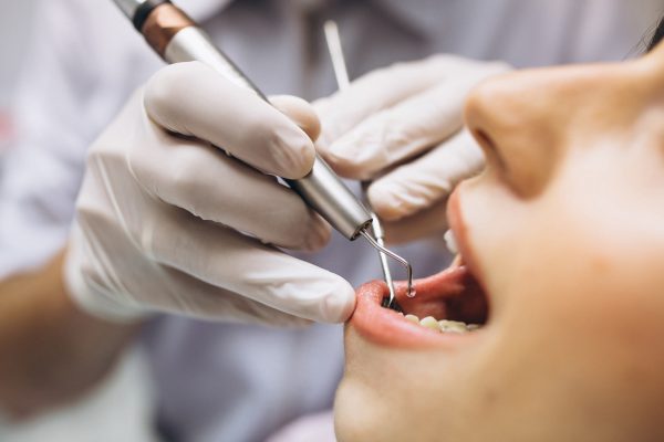 Restorations of Anterior Teeth