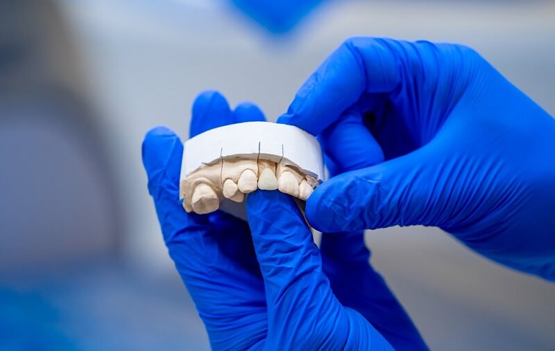 Якісне протезування зубів нові технології ортопедичної стоматології Фото 513