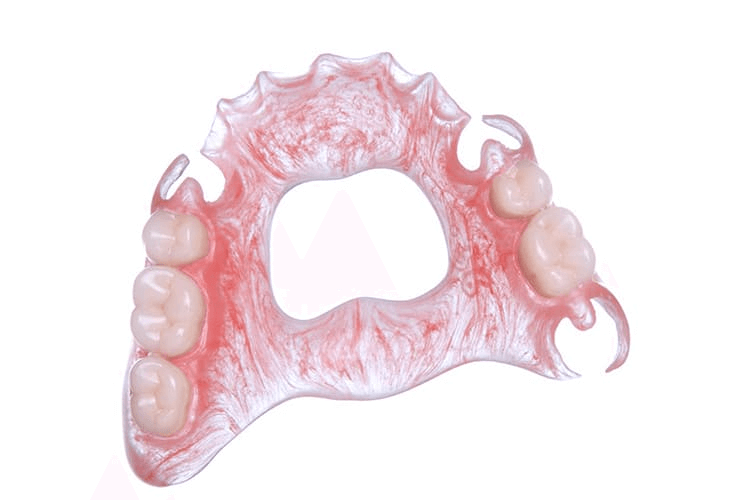 Nylon dentures