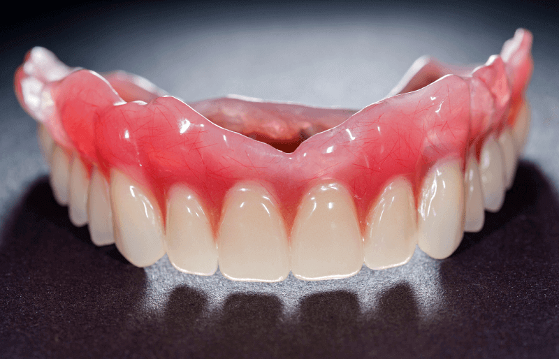 Lamellar dentures