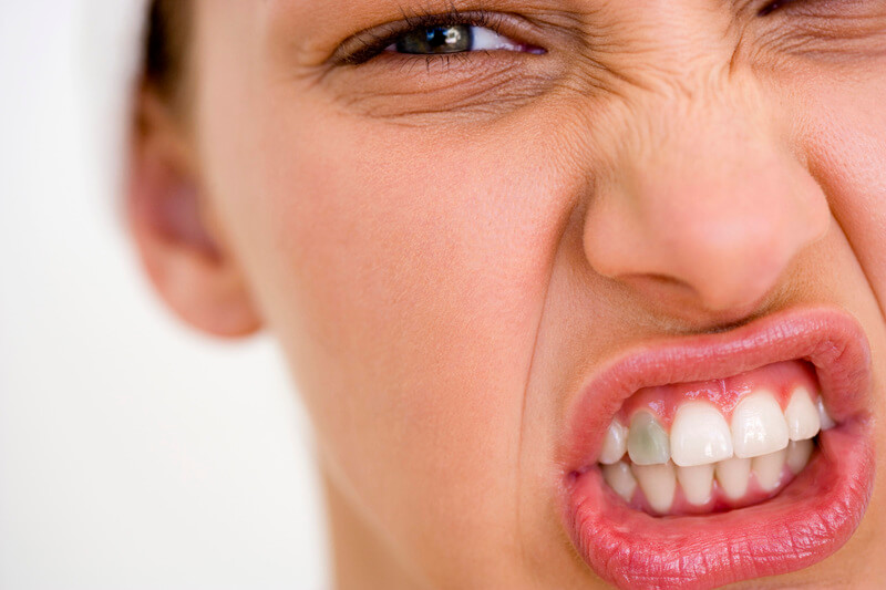 Потемнів живий зуб: при чому тут зубний камінь?