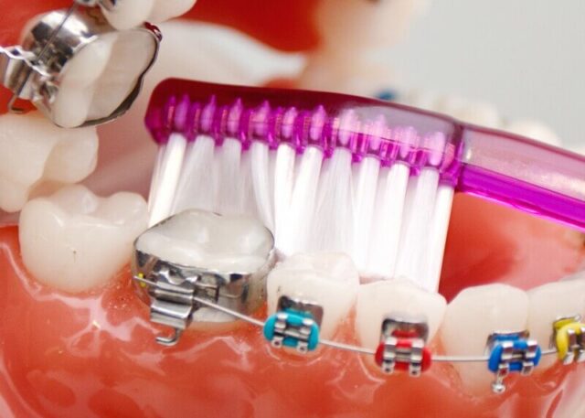 Brace Care Products