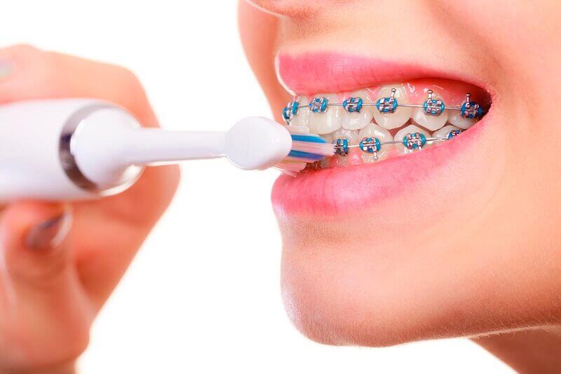 Зубні щітки для брекетів