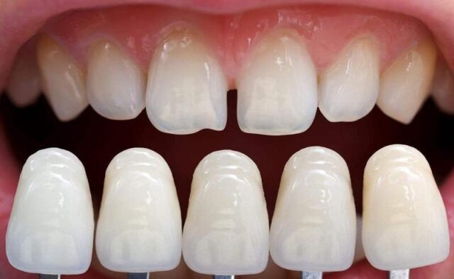 Artistic restoration