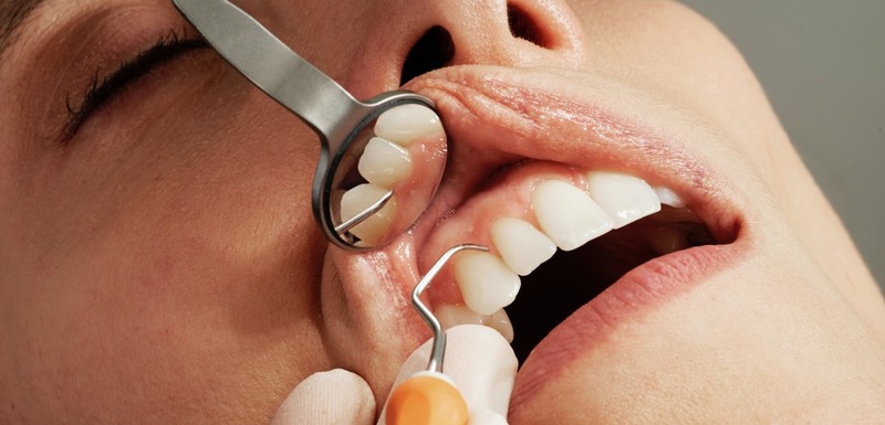Почему оголяются корни зубов