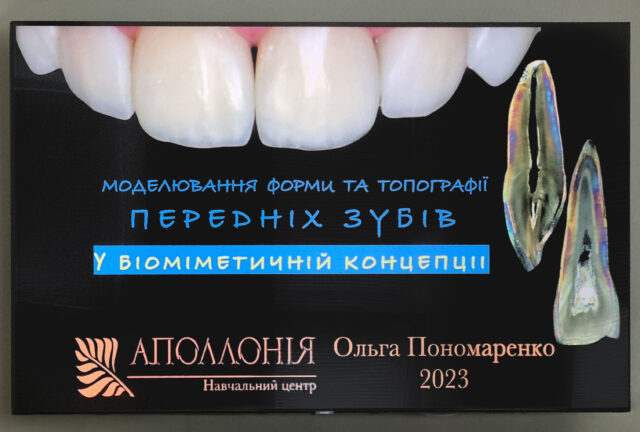 Моделирование формы и топографии передних и боковых зубов в биомеханической концепции