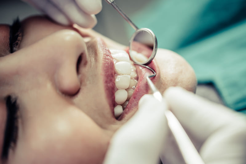 dentist treats patient's teeth