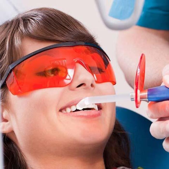 Матеріали для реставрації зубів