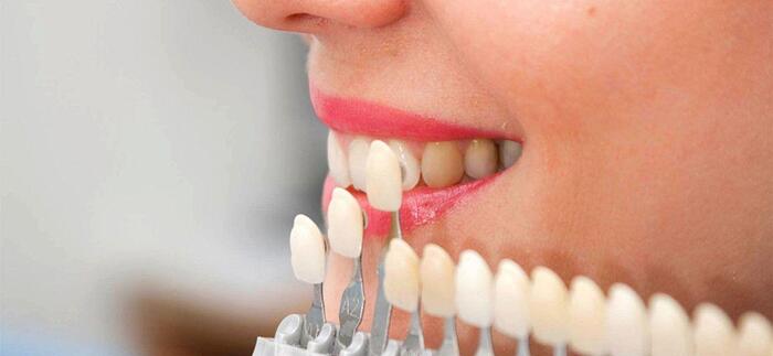 Фактори, що впливають на реставраціїю зубів