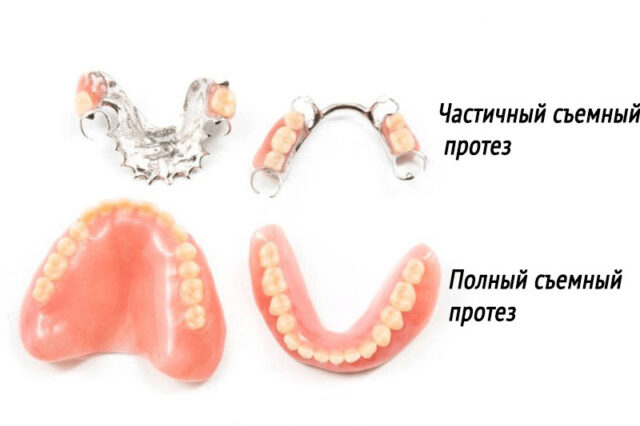 Полный и частичный съемные протезы
