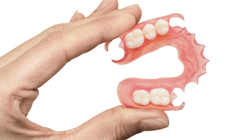 Removable Partial Denture