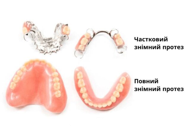 Повний та частковий знімні протези