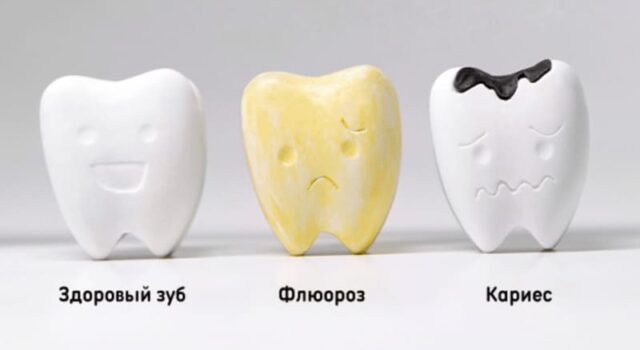 Черные точки во рту