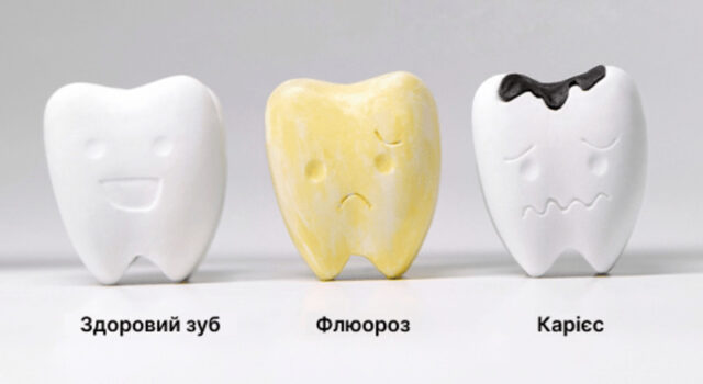 Чорні крапки у роті