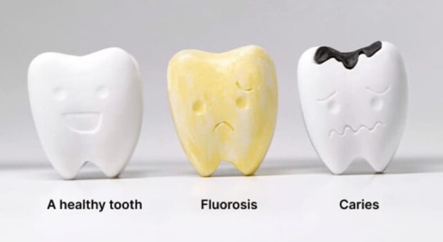 Dark Spots Inside Mouth