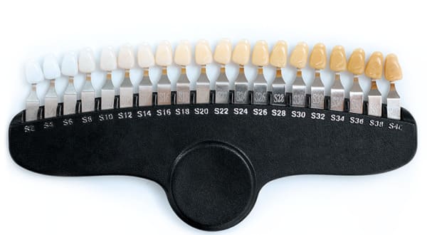 dental-restoration-img1