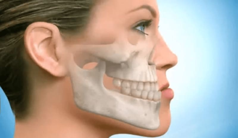 Frequent Causes of Jaw Clicking