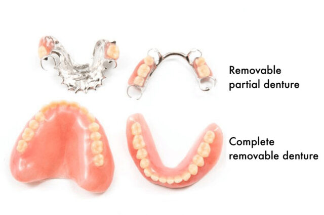 Complete and partial removable denture