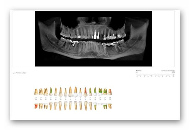 How do I treat my teeth