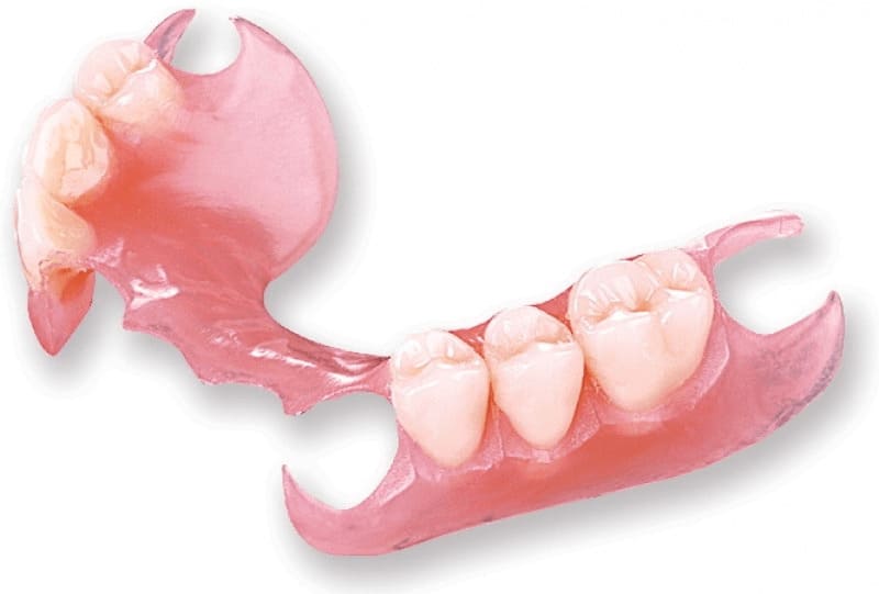 Immediate dentures