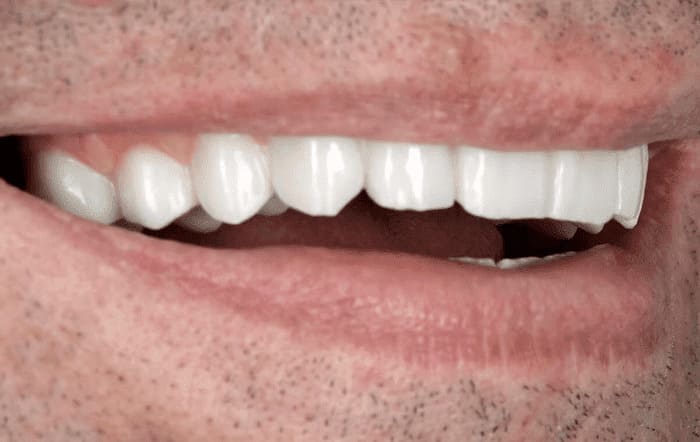 Какие зубы должны быть видны при разговоре